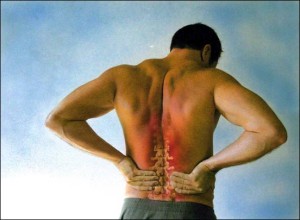 Dowagers Hump Treatment - Dr. Mike Snyder, D.C. - Gonstead Chiropractor &  Laser Therapy