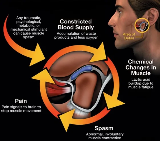 TMJ Treatment - Dr. Mike Snyder, D.C